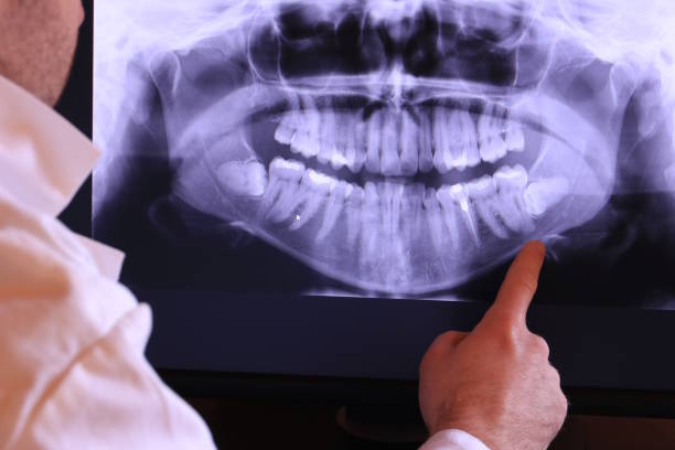 Best Emergency Care for Gum Disease in Tonganoxie, KS